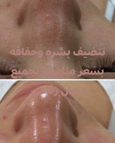 عنوان رفاعي

نص مكتوب في الصور:
- توريد شفه عنوان رفاعي
- ميشي صبغ
- صالون لمسة البداع
- رفاعي
- تنظيف بشره وحفافه بسعر مناسب لجميع
- مكياج مع تسريحا
- رموش شهري سبوعي