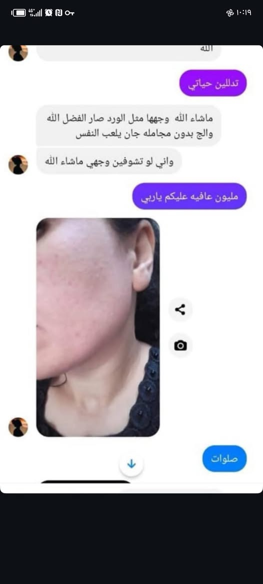 بنات العرض ع الخلطه الايرانيه العشبيه
٢٠ والتوصيل مجاني لحد الجمعه ويخلص العرص

نص مكتوب في الصور:
- In quiet mode هاي بعدنه ماكملت لا شهر ولا العلبه كلها بالكامره الاماميه مالت لايفون ماشاءالله تخبل تخبل حبيبي الفضل الج اكيد جانت دهنيه بشكل هسه متوازنه وتخبل عافيات هوه حلو بي يوازن دهون منع حبوب
- ماشاءالله تحسن حلو تمييز كعميل محتمل تعديل
- ورغم الكلف كلش كان قوي وغامق شوفي الفرق بين صورتين
- الله
- تدللين حياتي
- ماشآء الله وجهها مثل الورد صار الفضل الله والج بدون مجامله جان يلعب النفس
- واني لو تشوفين وجهي ماشآء الله
- مليون عافيه عليكم ياربي
- صلوات
- نعم تركيزة اقوة Unread messages كون وجهي يسمن بسرعه قبل شهر اخذت من عندج كبسول مبيض يجنن سو البياض عندي جنت حيل سمره هسه ماشاء الله يجنن واريد مصداقيتج بتسمين وجهي فدوه دكتوره