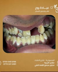 عياده روح لطب وتجميل الاسنان د.زهراء صادق   المحموديه شارع الأطباء مقا...