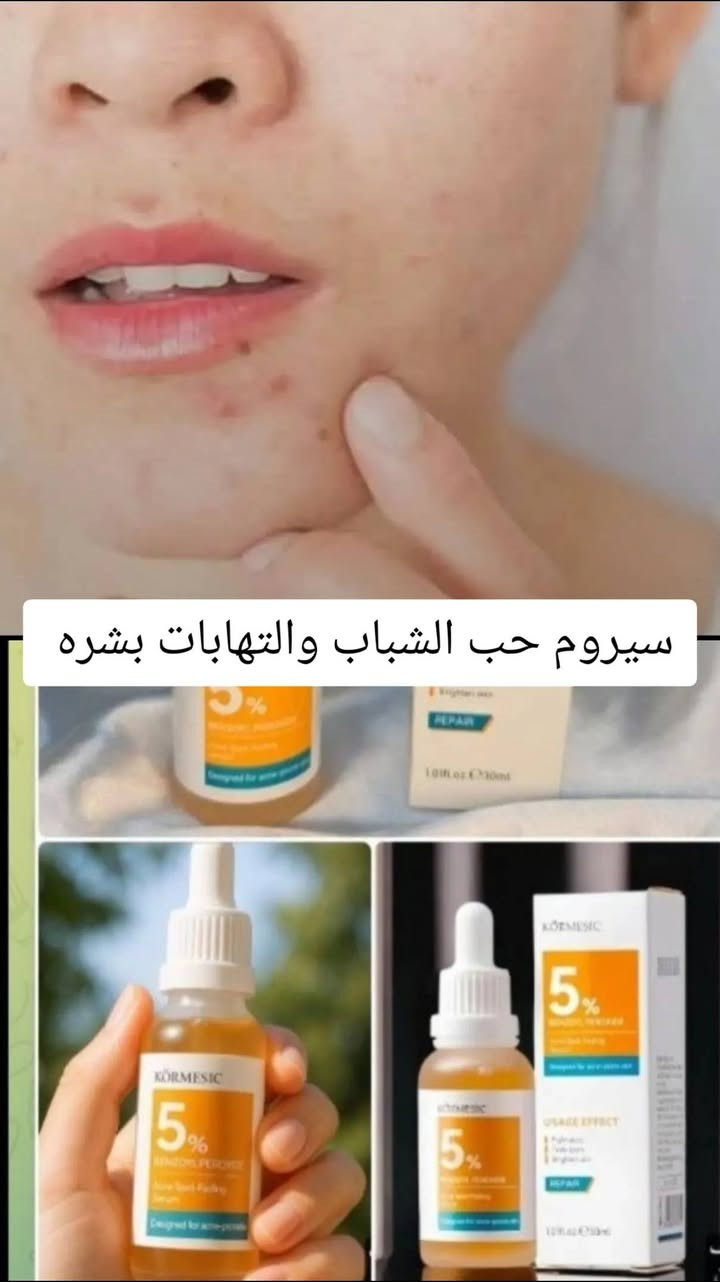 تونر كولاجين • سيروم حب الشباب • مقشر كلف ونمش
