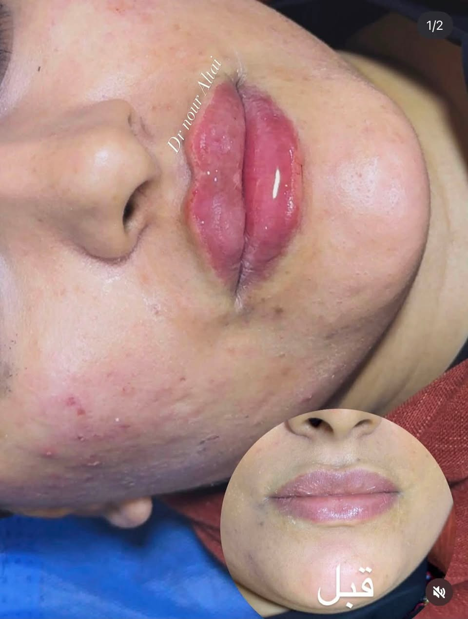 اني دكتوره تجميل هذا شغلي بالفلر والنظاره وهذا رقمي ***********
