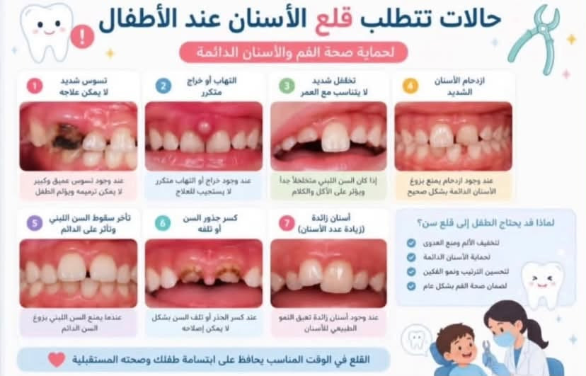 عيادات مجانية • اسنان اطفال • قلع اسنان
