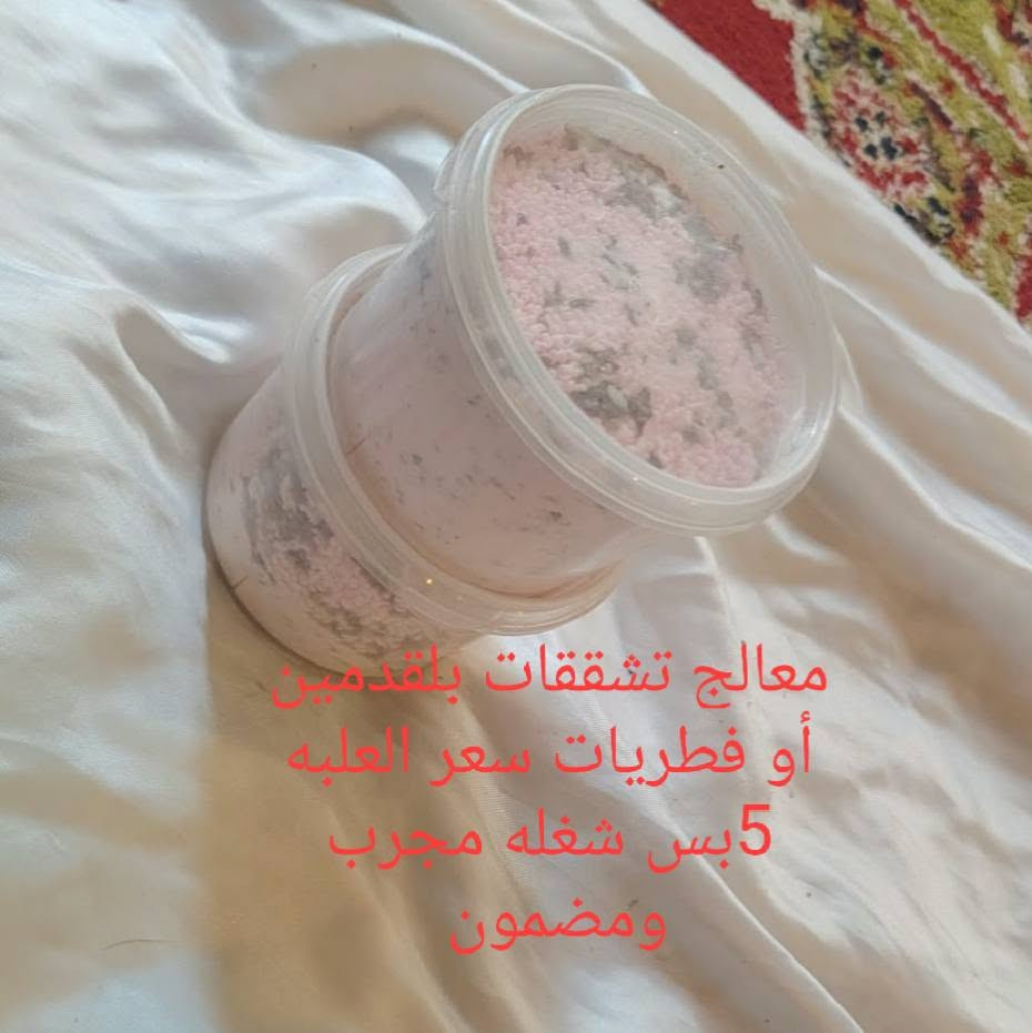 الرقم ***********يوجد توصيل الخاص مفتوح

