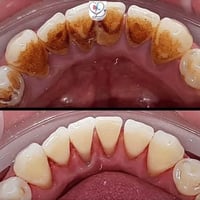تنضيف • تكلسات • خدمات تنظيف