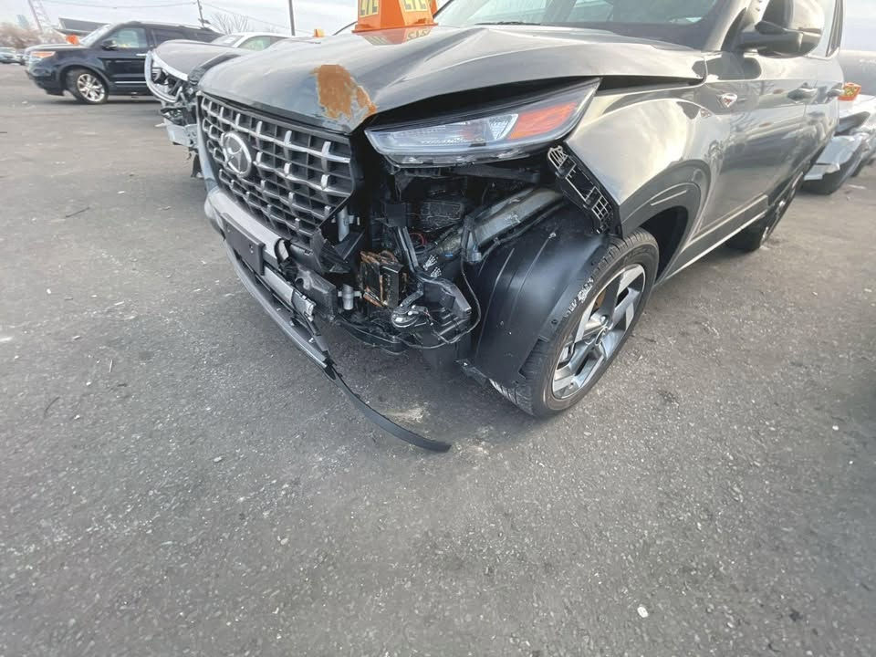 هونداي فينو موديل24لمتيد توكلر
بيها بارد بجاملغ الايسر وبالباب الخلفي على كد اربع اصابع …

3انظمه قياده 

تشغيل عن بعد 

تدفئه كشنات 

رادرات جانبي وامامي 

شاشه كار بلي 
السعر 143$
***********
