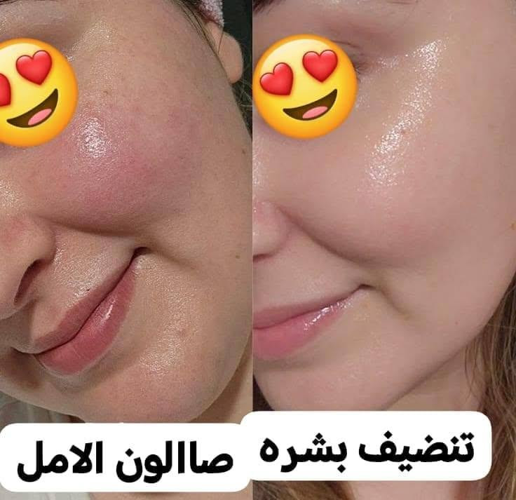 صالون الأمل • تنظيف بشرة • تنظيف قدم