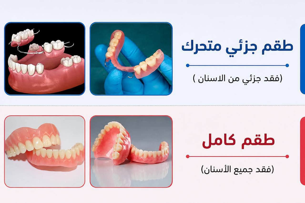 جامعة البيان • علاج مجاني • حشوات ضوئية