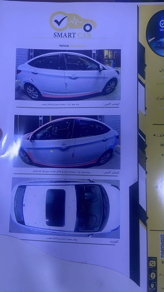 اكسنت 12 خليجي
فول  مواصفات 

محرك وكير مكفولاات 

1600 

تحويل مباشر 

رقم أنبار 

السونار مرفق ويه صور 

بدون حادث او تبديل 

نضيفه سياره كلش غرفته جديده 

محرك مكفول 

***********

واتساب 

متواجد بغداد ((سعر 85 وبيه مجال  بسيط
