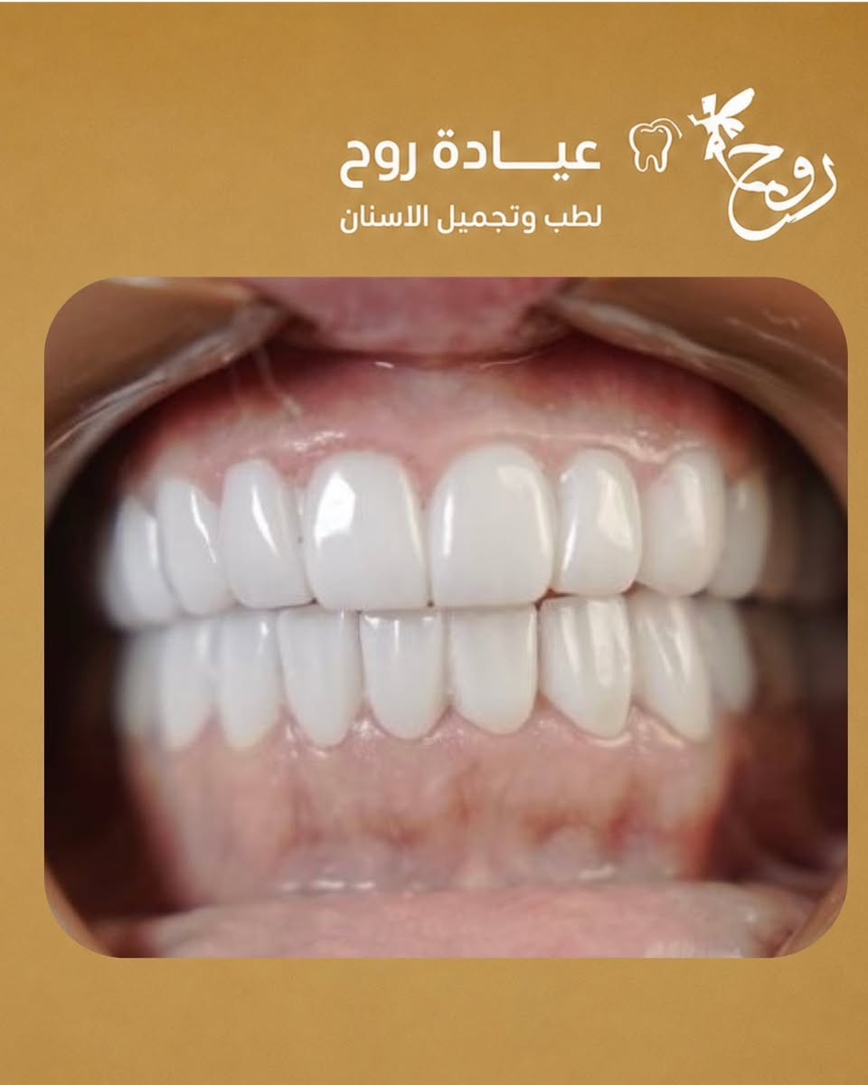 زيركون • تجميل اسنان • المحمودية بغداد