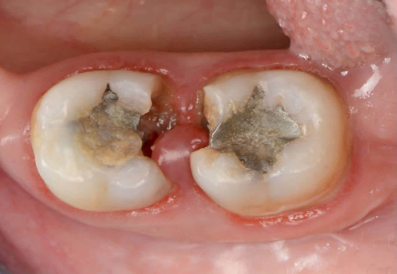 يتواجد الدكتور عمر اختصاصي طب الاسنان للحشوات وتجميل الاسنان في مجمع الحياة الطبي يوم غداً الخميس صباحاً.  
للحجز والأستفسار 
***********

