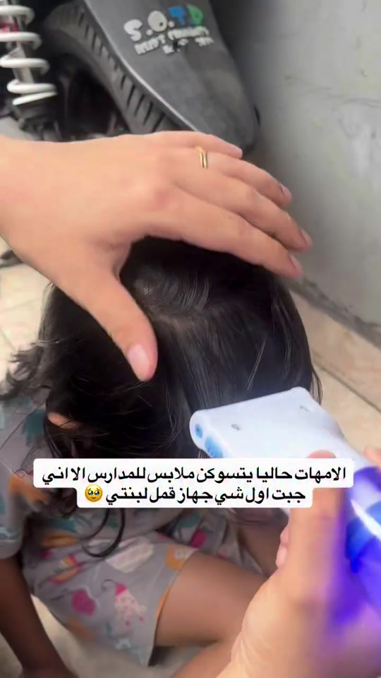 جهاز قمل الكهربائي السعر 15 الف مخصص لتمشيط الشعر مع شفط قمل الرأس والبيض أثناء الاستخدام. بعتمد الجهاز على الجمع بين التمشيط والشفط لنقل القمل والبيض إلى وحدة فلتر الالتقاط المخصصة لذلك. يحتوي على أسنان تمشيط مصنوعة من الستانستانلس ستيل بحواف مستديرة، مع إمكانية ضبط زاوية التمشيط بما يتناسب مع طريقة الاستخدام وتأتي وحدة الفلتر مزودة بإضاءة LED للمساعدة على رؤية محتويات الفلتر أثناء عملية التمشيط. يستخدم الجهاز فلتر التقاط قابلًا للاستبدال ومخصصًا للاستخدام مرة واحدة، مما يسهل التخلص من المحتويات بعد الاستخدام. يتميز بتصميم مدمج ومقبض مريح للاستخدام، ويعمل بالطاقة الكهربائية

نص مكتوب في الصور:
- الامهات حاليا يتسوكن ملابس للمدارس الا اني جبت اول شي جهاز قمل لبنتي 🥺