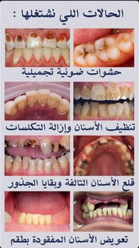 علاج مجاني • جامعة المعقل • خدمات أسنان