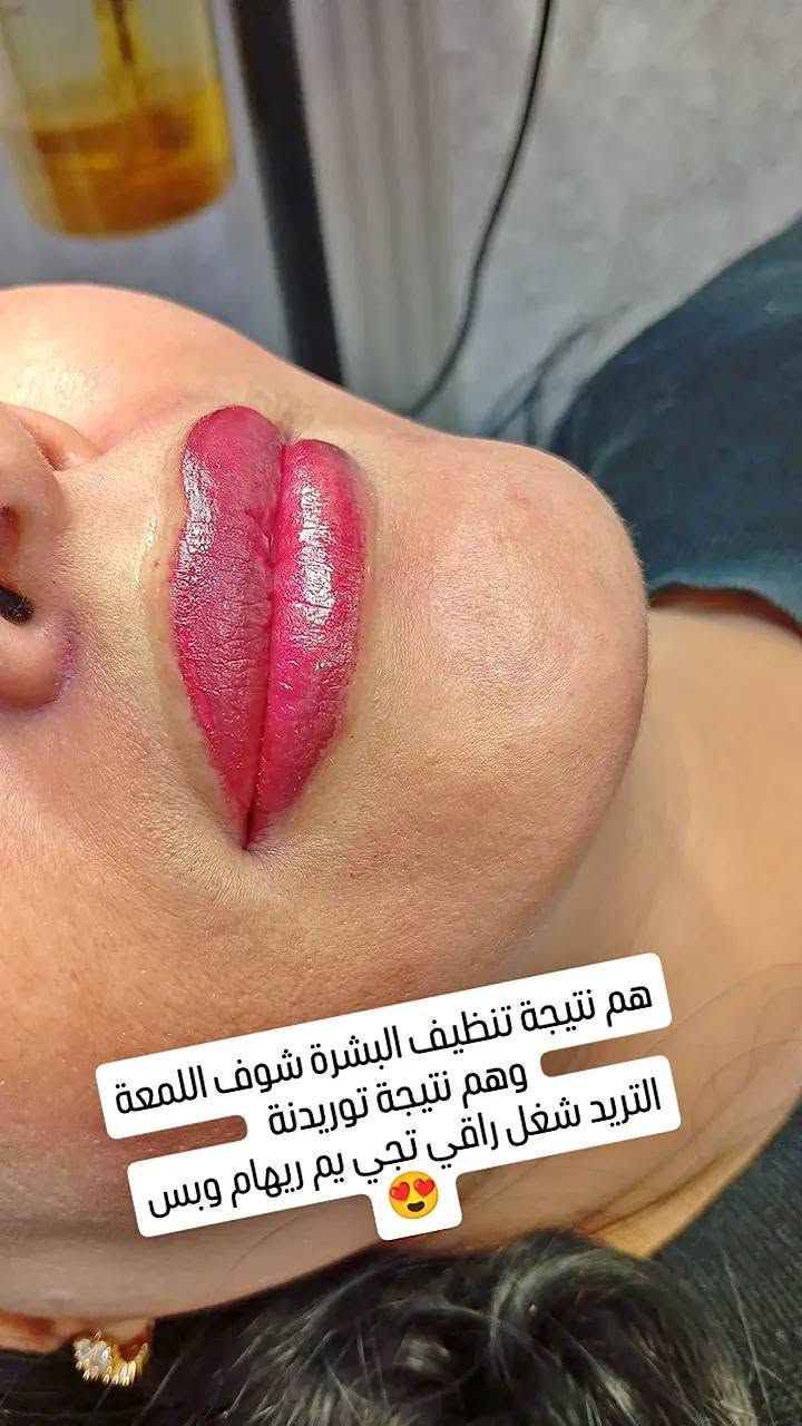 اليسا بيوتي • دهوك مالطا • تسريح ضمان سنة