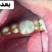 انقاذ سن • تاج زركون • ذي قار القلعه