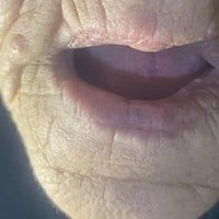 علاج مجاني • طقم أسنان كامل • عيادات ابن سينا