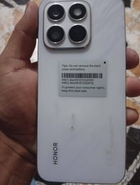 هونر X8c • ٢٥٦/٨ رام • ضرر بالظهر