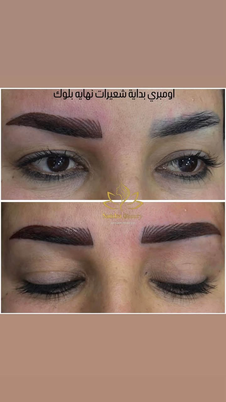 باشراف الدكتورة زهراء عدنان المحنة✨✨

 انتبهو ياحلوات للجمال ونظافه شغلنا بالامبري مقدمه شعيرات ونهايه بلوك🔥🔥🔥

🔥💥 مع ثبات اللون بعد التقشير بس يمنا🥰🥰

يعني ندللكم دلال🤩🤩
بعد لاتحتارين حاجبج معاجبج🥲
عندج تاتو قديم🥹
حابه تغيرين شكل حواجبج الطبيعيه🫠
تعالي يمنا نعيد تغير الشكل برسمات محترفه😌😌
كل الانواع متوفرة😍😍

ع يدين افضل المحترفات🔥في عالم التاتو والتغير الطبيعي 😌خريجه اكاديميه الفايبروز العالمية ✅

كل الاحبار اصلية💯 ✅

🏠العنوان الديوانيه🏠👇👇
العروبة الاولى 
داخل  فرع سنتر دولار🔥🔥
للاستفسار 👇☎️
***********
***********
