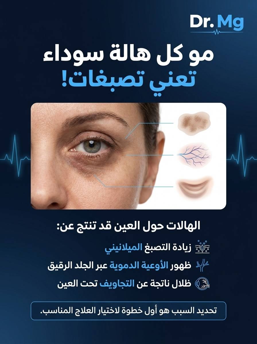 هالات تحت العين • عناية بالبشرة • استشارة خاصة