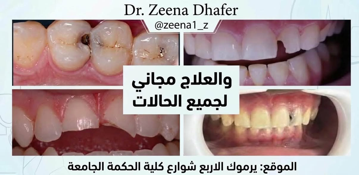علاج مجاني • أسنان أطفال • يرموك كلية الحكمة