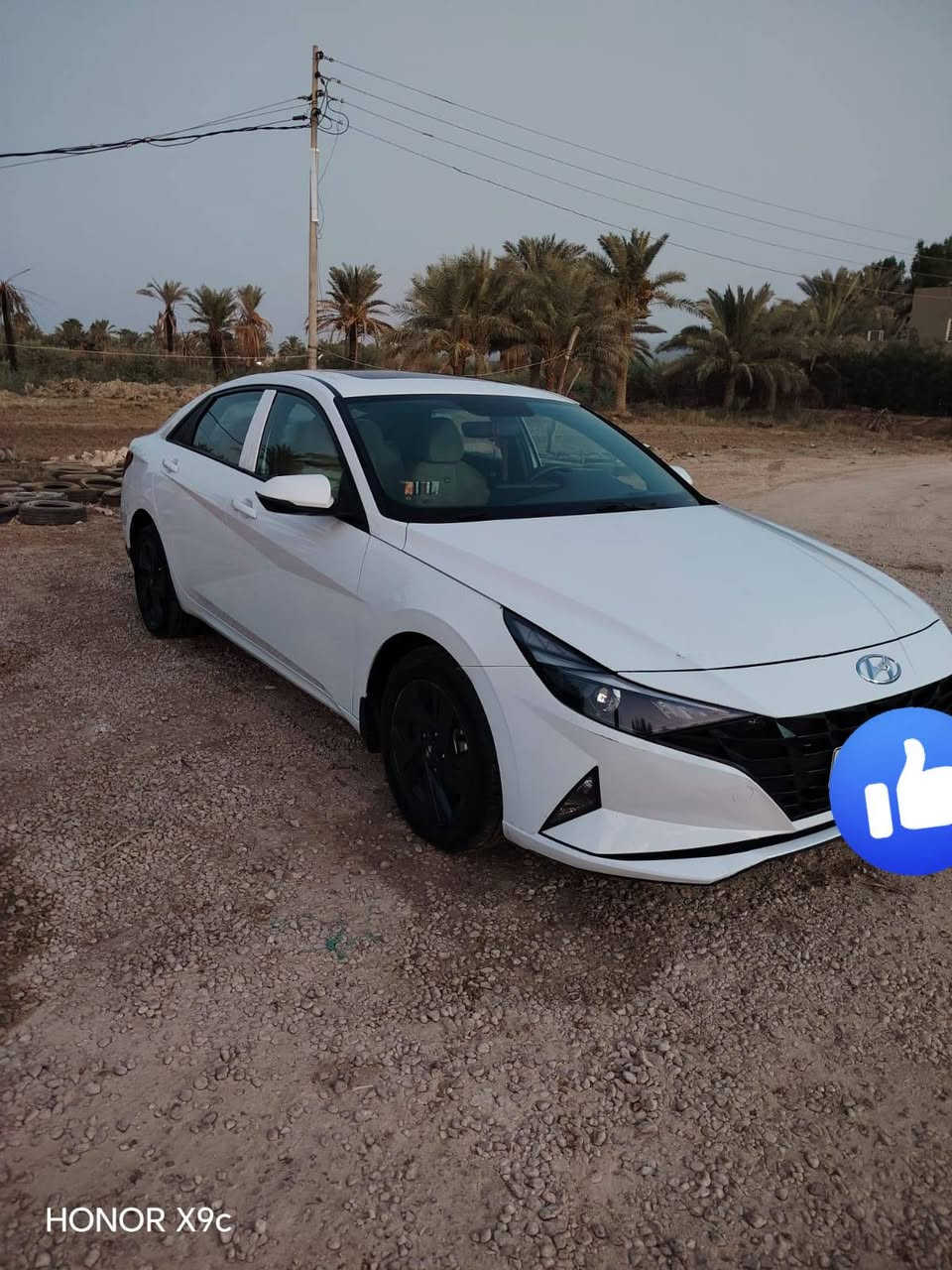سلام عليكم من رخصة الادمن سيارة النترة وارد خليجي 2023مكفوله  كفاله عامه عده اصبع بالبنيد بارد فحته بالقمارة كير مكينه كفاله حدادية جديدة شاشه منفصل وبعد مواصفات الخليجي معروفه رقم اربيل تحويل بسم المشتري (((((اني مكلف بالنشر اني مكلف بالنشر اني مكلف بالنشر اني مكلف بالنشر)))))((((***********هذا رقم صاحب السيارة))))

نص مكتوب في الصور:
- HONOR X9c