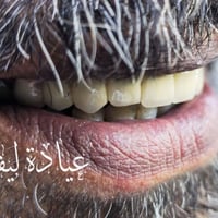 تركيب أسنان ثابت • سيراميك زاركون ايماكس • الناصرية