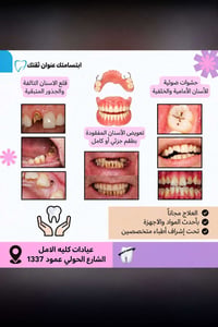 مجانا • حشوة ضوئية • تعويض أسنان