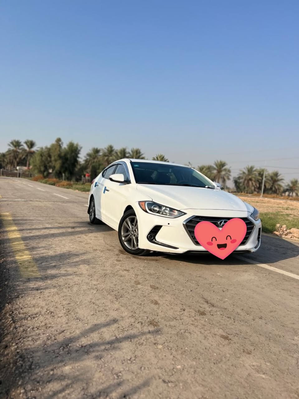 النتره 2018 امريكي الفول مواصفات فتحه سقف محرك 2000 دوش السياره تخبل لجنايه حاكية اتصال رادار3 مودات قياده 3 سبورت وعادي واقتصادي ماعوزه شي تشغل وتمشي كم شغله عوزه فقط مو مهمات.  السياره مصبوغه عام اتكفلك شاصي لغد دواخل ومحرك وتحويل  93 وبيه مجال 
***********
