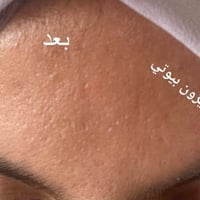 بيبي كلو • ديرما بن • نضارة