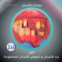 بلاتينيوم كلينك • عيادات أسنان • المحمودية حي ١٧
