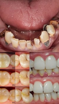 علاج اسنان مجاني • جامعة البيان • أطباء اختصاص