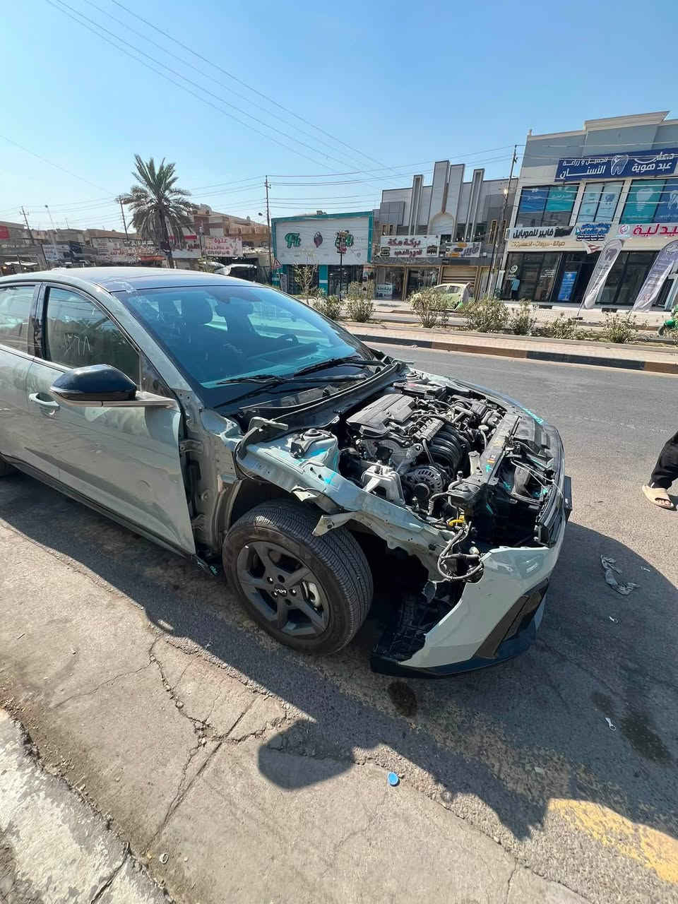 السلام عليكم للبيع كي 4 وارد امريكي جيتي لاين بدون ايرباك ماشيه 2000 بعده زيرو هذ حادثه موضح فقط بنيد وجاملغ شاصي لغد مكفول فقط الفخذه يرادله سحب مكان بغداد السياره فولل تشتغل وتمشي السعر 150 وببه مجال بسيط البارحه دخلت السياره مكمركه حره منفيست بسمي ***********
