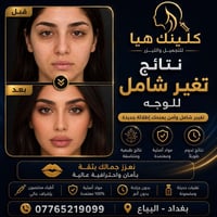 07765219099 البياع تقاطع الشرطه الرابعة يم مطعم السديل