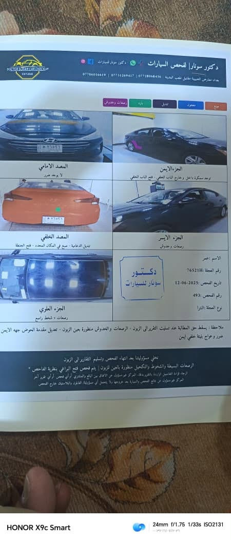 سلام عليكم 
الانترا ٢٠٢٠⚡️⚡️
للبيع فقط
مواصفات 
1️⃣ تحكم استيرن 
2️⃣ تحديد مسار  
3️⃣ رادار
4️⃣ مانع انزلاق 
 سيارة مواصفات نص فول 
تبريد ثلج ❄️
محرك٢٠٠٠ دوش 
سياره ادامة كامله  منظومة البانزين
قبل شهر سويته
 
وارد امريكي 🇺🇸

السعر ١٢٥$وبيه مجال للشراي 
رقم تليفون ***********
