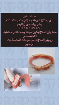 طقم جزئي متحرك • علاج مجاني • عيادات الجامعة