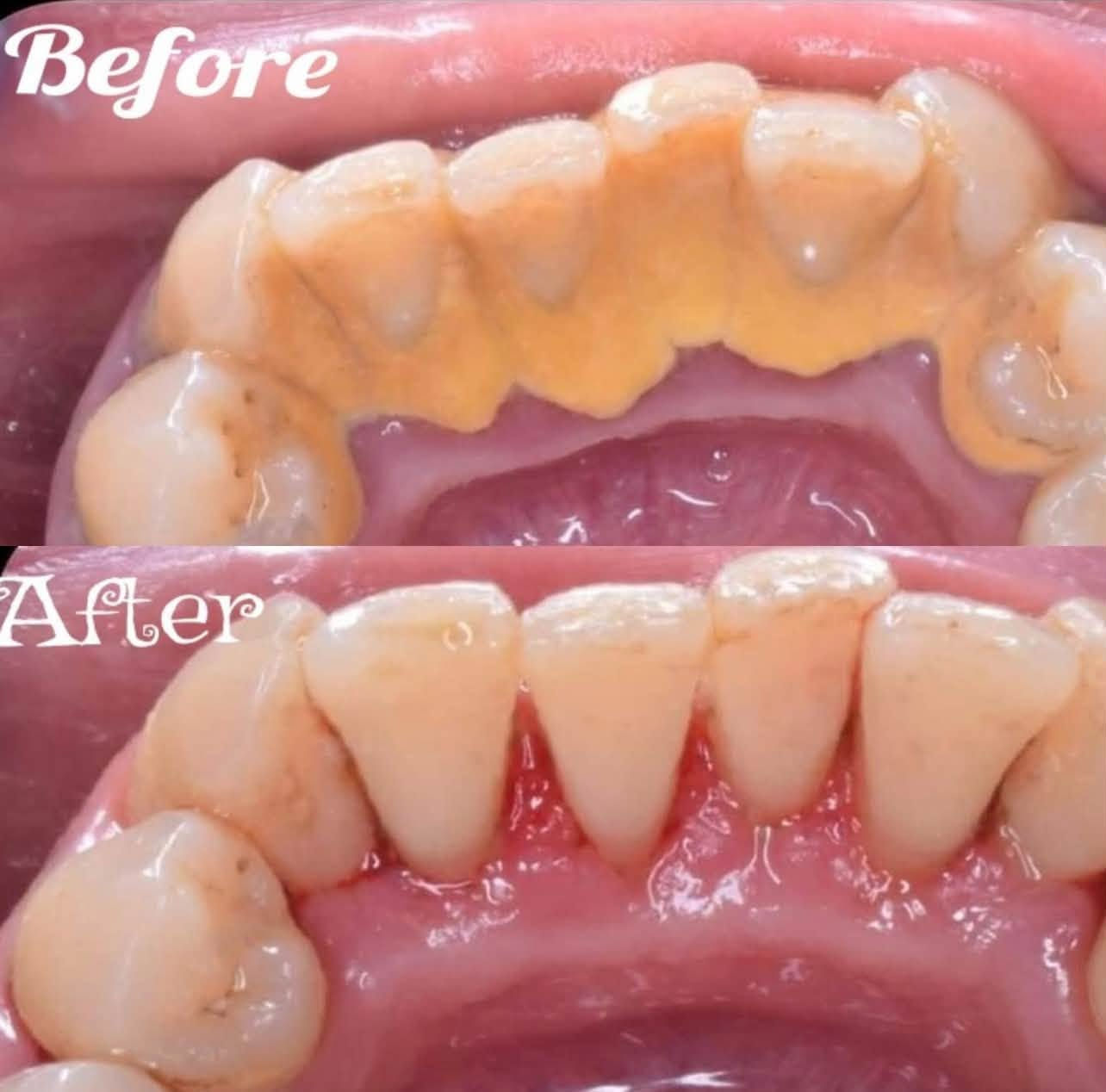 مجاناً • حشوات تجميلية • جامعة الفراهيدي
