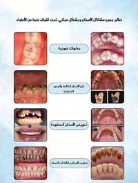 خدمات اسنان • مجاني • جامعة الاسراء