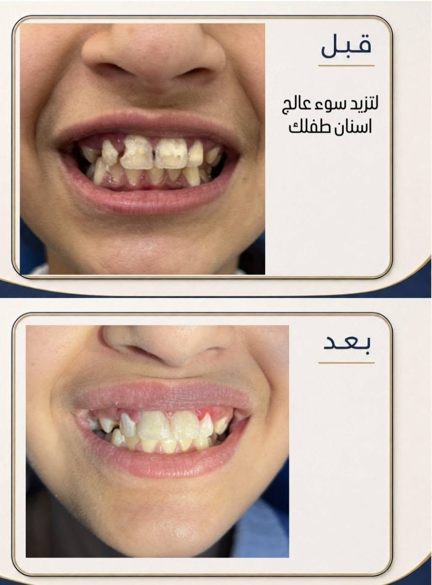 عيادة الهدى • أسنان وتجميل • تقاطع الجدوع