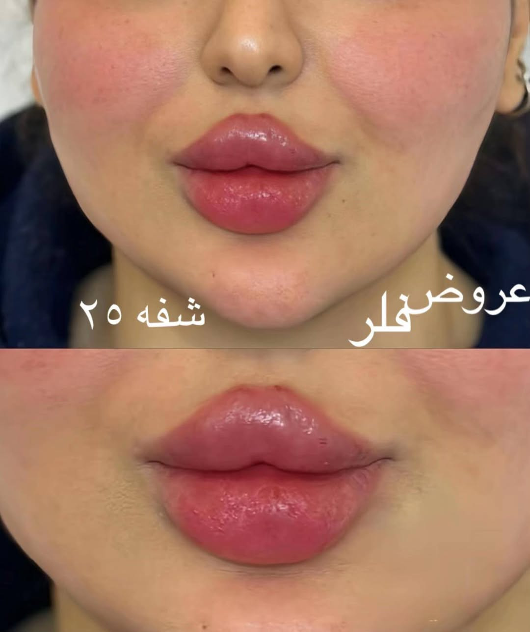بنات اني بس انشر مرسالة المركز ***********
