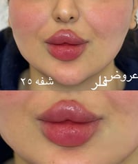 بنات • مركز تجميل • إعلان المركز