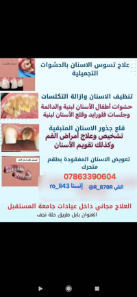 علاج تسوس • حشوات تجميلية • علاج مجاني