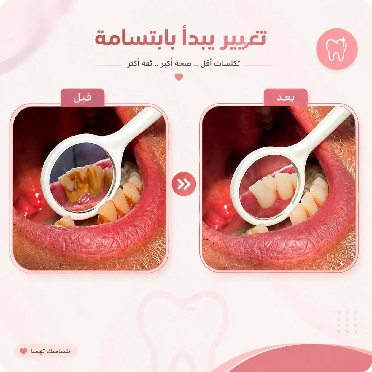 سلام عليكم
يتوفر علاج مجاني للاسنان وتحت اشراف اطباء اختصاص 
للي حاب يستفسر راسلونا ماسنجر او ع الرقم ***********
