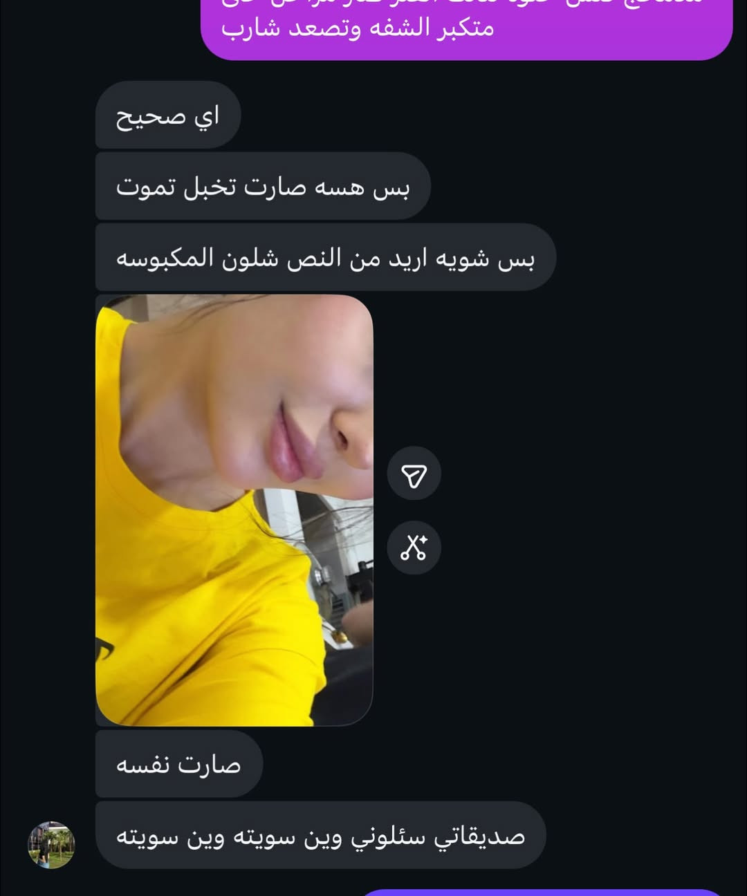تجارب المراجعات صوت وصورة💗🍒💉
حاليا مسويتلكم اقوى العرض ومستحيل تتكرر بعد هاي العروض لان بفترة قصيرة بالمسيب حققنا نجاح الحمدلله وصارو مراجعينا هواي ويطلبون من عدنا عروض 💗💉🍒💯 

*****العروض هاي قوية وفقط هذا الشهر مراح تتكرر ابداً*****

ممكن بعدين نسوي غير عروض بس مثل هاي متتكرر💗

للاستفسار عن العروض واسعار الفلر البراند حصراً 

وابر النضاره اما دايركت مسج 

او https://www.instagram.com/p/Dc8uh21sHun/?stkn=cmpyejkwZ2EwcjAy

او واتساب مسج ***********

المسيب شارع البلدية

💗💉

— في ‏المسيب‏.

