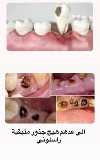 � رجعت العيادات، وراح أرجع أستلم حجوزات! إذا عندك/ج سن مأجل علاجه من ز...