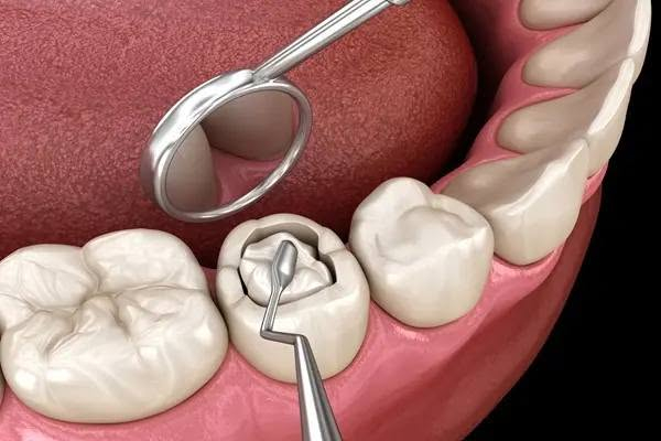 🦷🤍 علاج أسنان مجاني 🤍🦷
السلام عليكم ❤️

 نستقبل مرضى للعلاجات التالية مجاناً ✨

🦷 قلع الاسنان و جذور الأسنان المتبقية
🦷 الحشوات الاعتيادية
🦷 تنظيف الأسنان وإزالة الترسبات
🦷 الأطقم الجزئية المتحركة

📍 المكان: جامعة المشرق – خدمي المطار ✈️

📞 للحجز والاستفسار: ***********

إذا تحتاجون أي علاج من هاي العلاجات أو تعرفون أحد يحتاج، لا تترددون بالتواصل ويانه ❤️

[علما ان العلاج تحت اشراف اطباء مختصين] 

🩷 ابتسامتكم تستاهل العناية! 🦷✨

