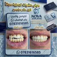 مجانا • صالون • حجز