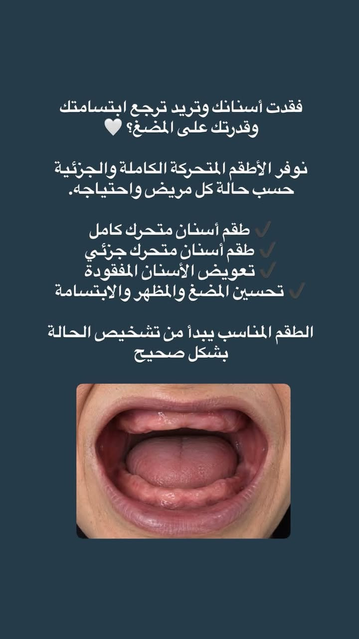 البصرة شارع التجاري • تنظيف أسنان • حشوات تجميلية