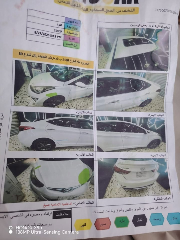 النترا 16 خليجي فول مواصفات رقم بغداد انكليزي بااسمي تحويل مباشر
ماشية ١١٦ حقيقي

بيها تبديل قطعتين بدون دواخل 

مكينه ١٨٠٠ دوش بلاديه كفالة

تبريد قطعتين ثلج 🧊

كهربائيات كلها شغاله عله وضع الشركة

غرفه ودشبول جديد

مكان بابل

السعر ١٠٠

***********

*********** واتساب
