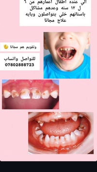 اطفال ٦-١٢ • علاج اسنان • تقويم مجاني