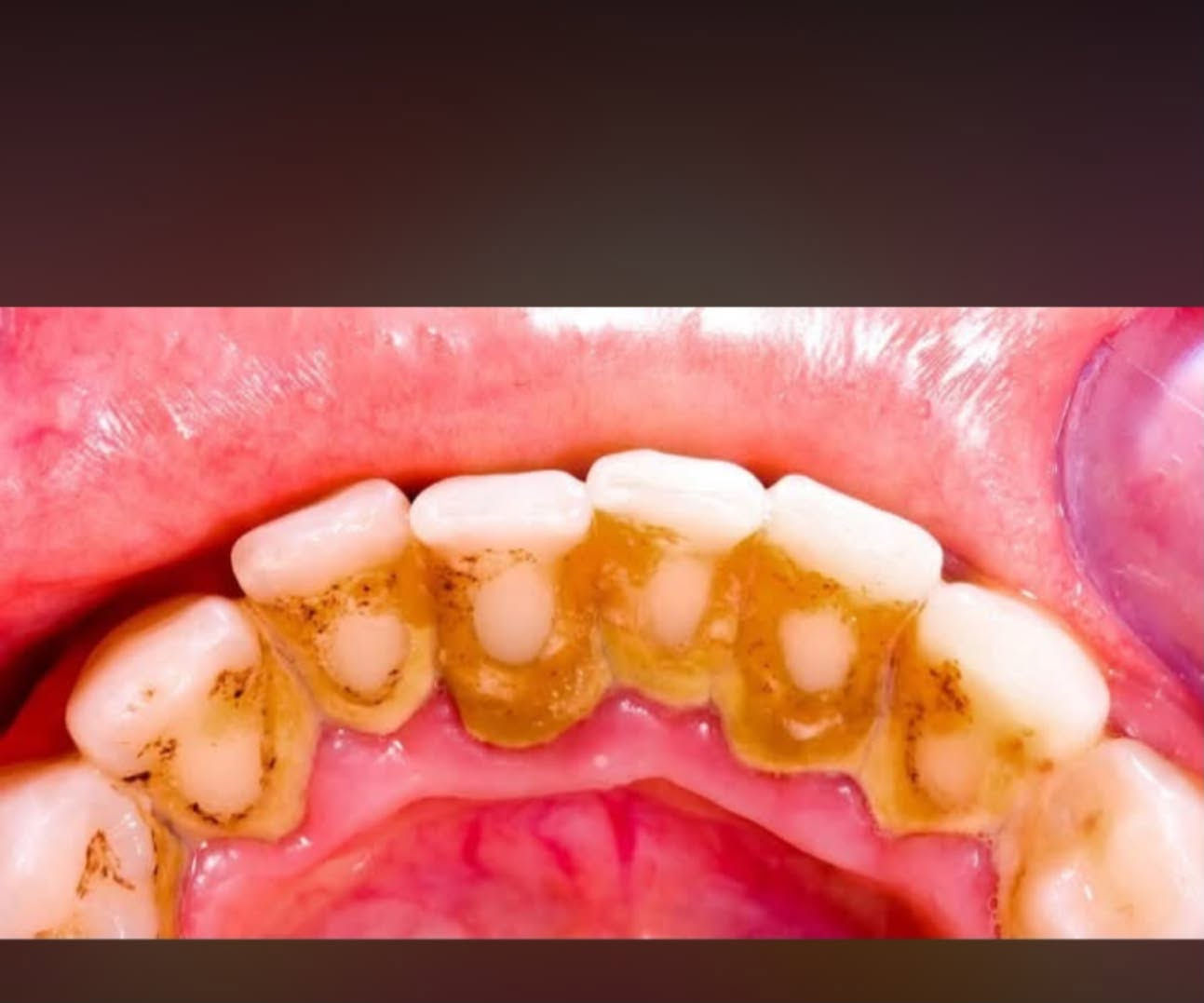تنظيف اسنان • حجز موعد • تواصل خاص