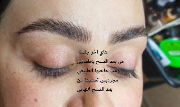ازلاله مسح بماده حبريه امريكيه اجنن من اول جلسه بدون اي تأثير عل الجلداوحروق يرجع حاجبج طبيعي بشرط 👍
المدربة الكوافيره ام محمد 🧿🧿
صالون ورده بغداد 🌺🌺
والاستفسار على الواتساب 👈 ***********☎️🧿

السماوه حي الحسين 🙏🧿
خلف مطعم بولفارد
على الحجز قبل بيوم👉👉👉📞
ازلاله مسح بماده حبريه امريكيه اجنن من اول جلسه بدون اي تأثير عل الجلداوحروق يرجع حاجبج طبيعي بشرط 👍
